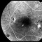 Okulistyka i Optometria